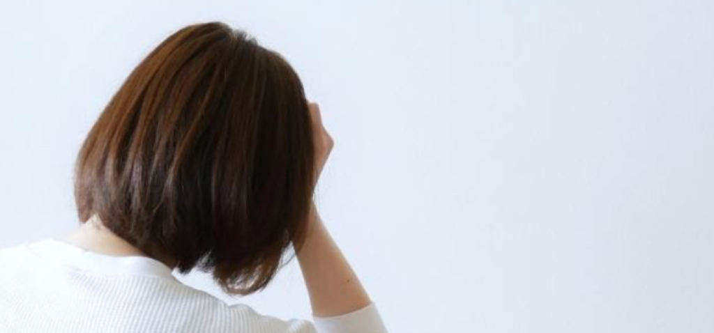 脱毛症に悩む女性